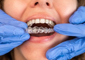 Woman at Invisalign checkup 