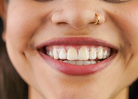 a bunch of Invisalign aligners on blue background