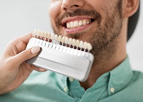 Man choosing shade for teeth whitening 