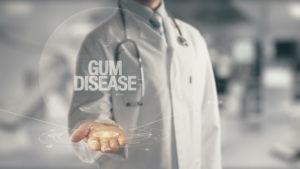 gum disease graphic